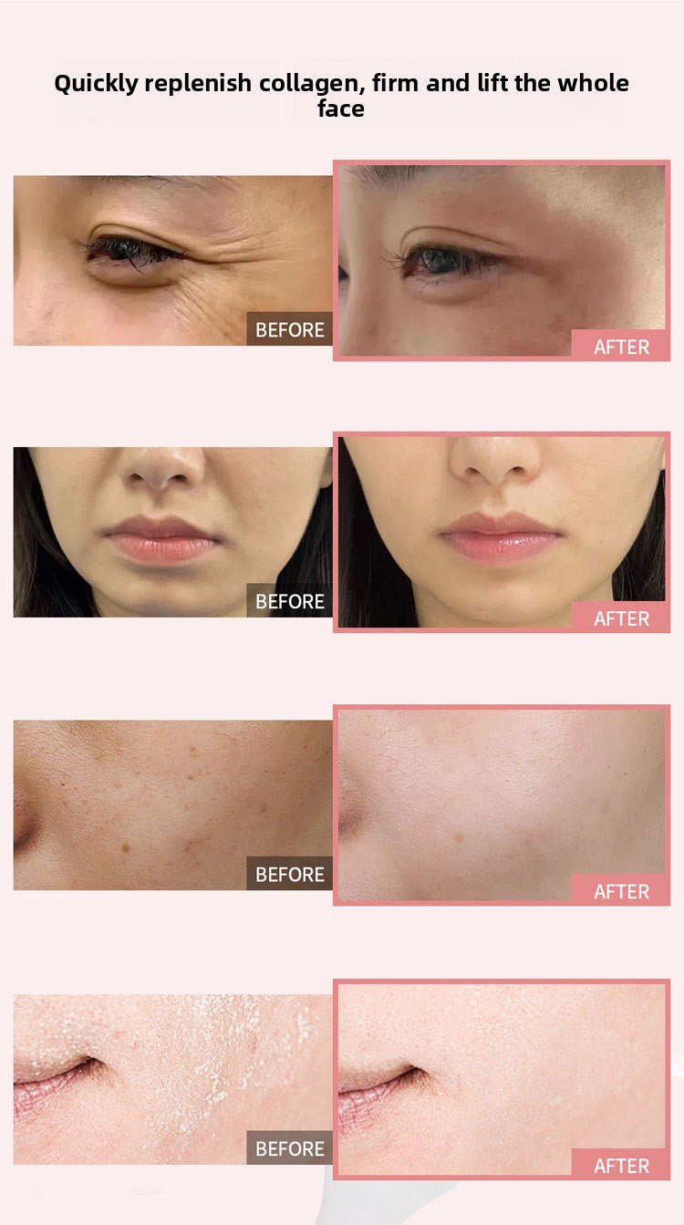 Collagen Jelly Cream – Firming & Hydrating Moisturizer ✨
